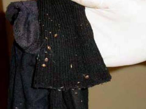 Pictures of Bed Bug Infestations: Bed Bugs on Clothing